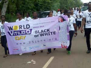 The Vitiligo Englightenment Walk, Coal City, ENUGU 2014 The Vitiligo Englightenment Walk, Coal City, ENUGU 2014